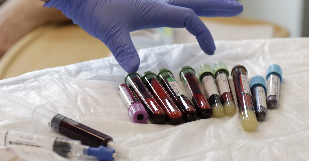 DNA from blood samples could help early cancer detection, Wisconsin researchers say