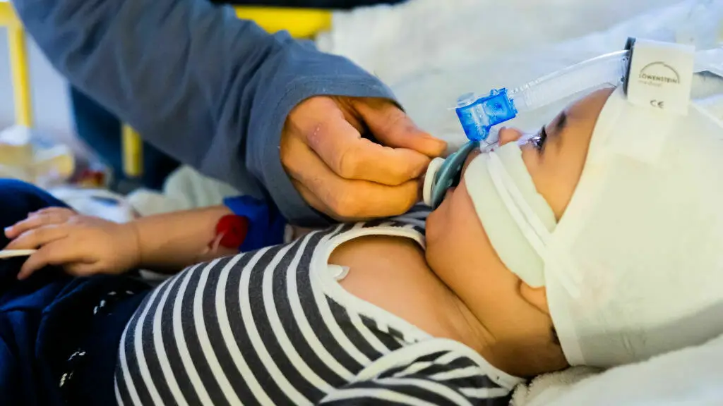 New therapy to stop critical RSV signs in infants could also be authorized quickly : Photographs